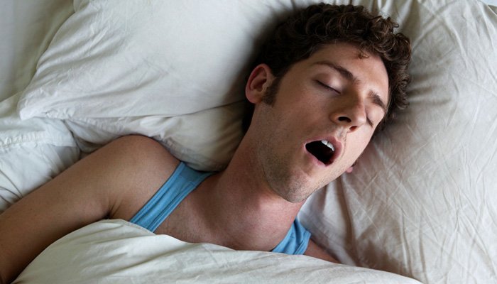 sleeping-with-open-mouth