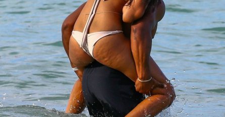 MUŠKARCI SANJAJU O NJOJ, A PUNA JE CELULITA: Mislili smo da ima savršeno tijelo, ALI ČEKAJTE DOK VIDITE BLIŽE (FOTO)