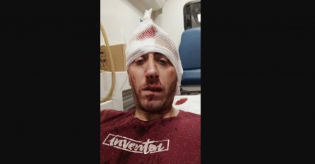 POTVRĐENO: Tužilaštvo napad na novinara tretira kao pokušaj ubistva