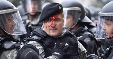 KO JE POLICAJAC KOJI JE POVRIJEĐEN NA JUČERAŠNJIM PROTESTIMA: Status Nihada Aličkovića digao buru u javnosti!