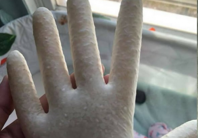 Ona redovno RUKAVICE PUNI RIŽOM: Kada vidite razlog ODMAH ĆETE URADITI ISTO!