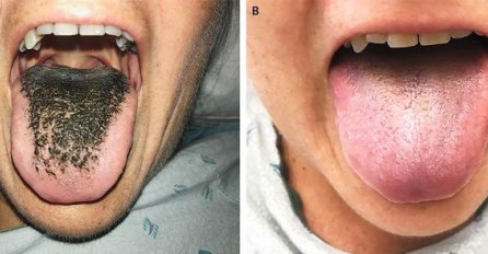 BIZARNO, JEZIK JOJ POCRNIO I PODLAKAVIO: Kad je saznala zbog čega nije mogla sebi doći!