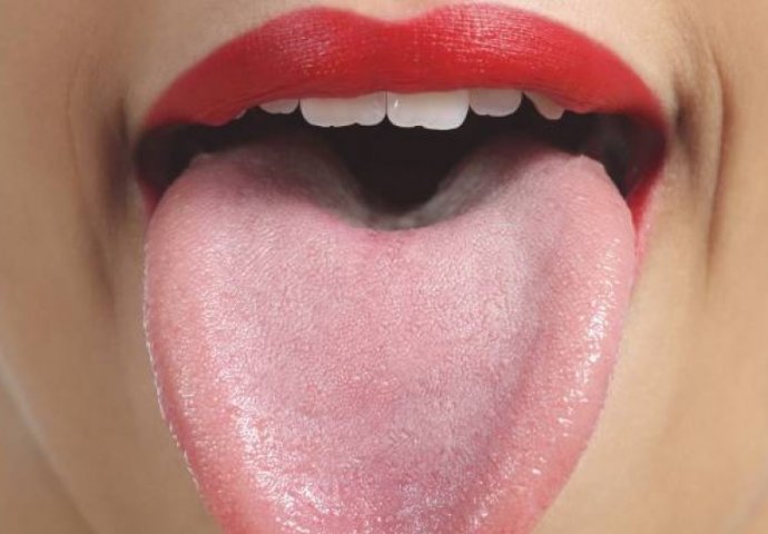 POSEBAN OPREZ ZA PUŠAČE - EVO ŠTA ZNAČI KAD IMATE BIJELI JEZIK: Ni slučajno ne ignorišite, 1 simptom je znak da HITNO MORATE DOKTORU