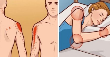 BOLI VAS LAKAT ILI RAME, A NISTE SE NIGDJE UDARILI? Uradite samo jednu stvar i bol će zauvijek nestati!