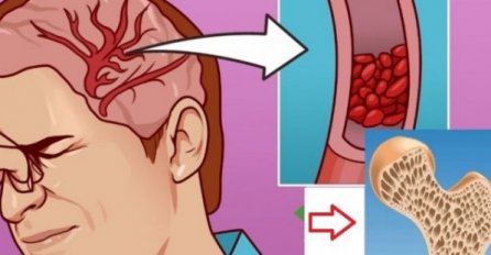 5 ZNAKOVA DA VAM TIJELU NEDOSTAJE MAGNEZIJ: Ako uočite ove simptome, odmah reagujte, bez magnezija naš organizam ne može pravilno funkcionirati