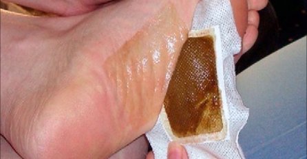 NAPRAVITE KOD KUĆE DETOKSIKACIJSKE FLASTERE: Zalijepite na stopala i dogodit će vam se ČUDO! 