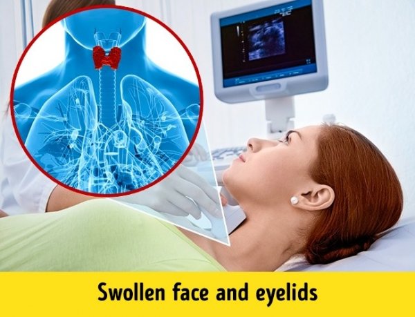 zd3