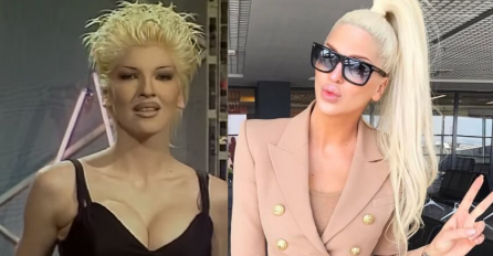 URNEBESNE FOTOGRAFIJE ZVIJEZDA PRIJE OPERACIJA: Neke od njih bi teško i rođena majka prepoznala!