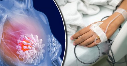 DOKTORI OTKRILI, OVO MESO IZAZIVA RAK DOJKE: Ni slučajno ga nemojte jesti!