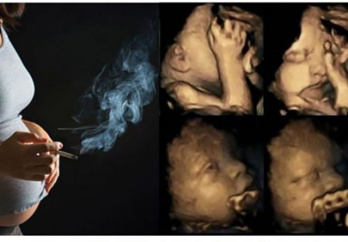 Istraživanje je konačno dokazalo: Pogledajte da li pušenje u trudnoći UTJEČE NA RAZVOJ DJETETA!
