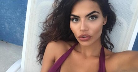 SRPSKU MANEKENKU PROZIVAJU ZBOG PLASTIČNIH OPERACIJA: A niko ne zna kakav je PAKAO preživjela!