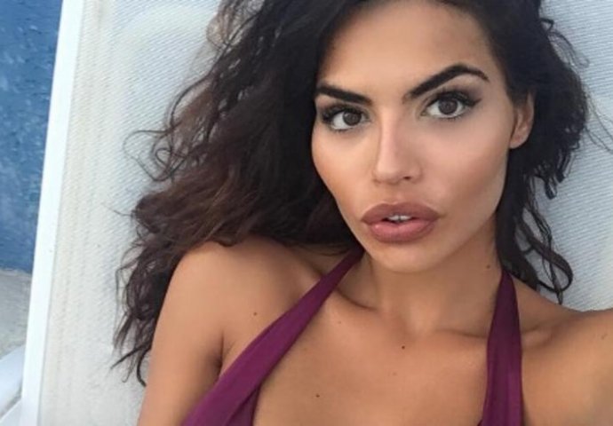 SRPSKU MANEKENKU PROZIVAJU ZBOG PLASTIČNIH OPERACIJA: A niko ne zna kakav je PAKAO preživjela!