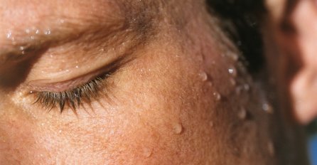 OVO MORATE ZNATI AKO SE BUDITE SA ZNOJEM NA LICU: Evo na koju bolest ukazuje često znojenje