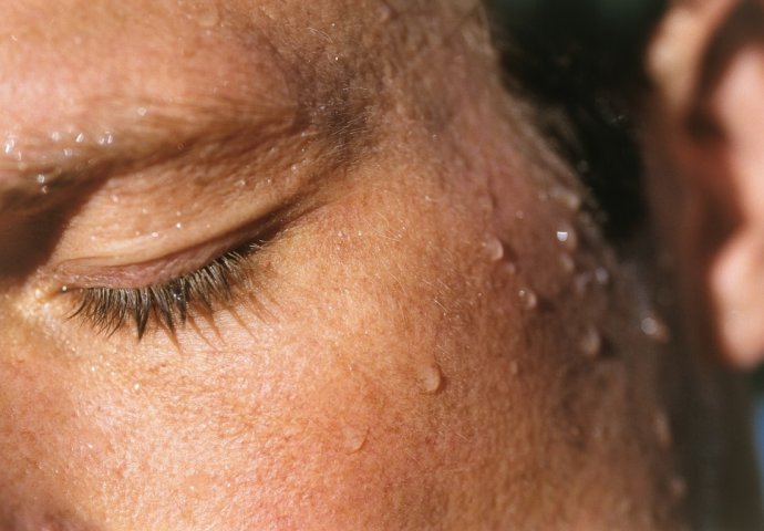OVO MORATE ZNATI AKO SE BUDITE SA ZNOJEM NA LICU: Evo na koju bolest ukazuje često znojenje