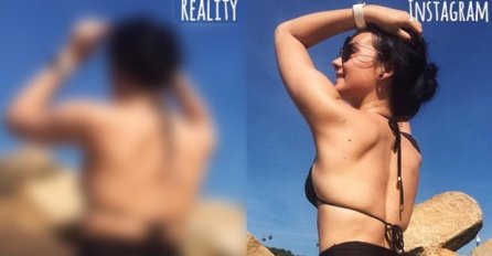 IINSTAGRAM JE ČISTA LAŽ: Kad pogledate kako stvarno izgleda ova djevojka, shvatićete zašto! UŽASNO I GLEDATI! (FOTO)