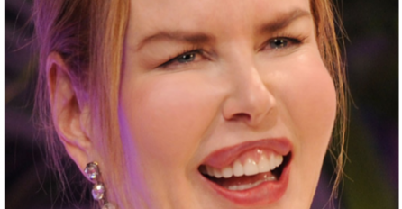 ŠTA URADI OD SEBE, A BILA JE JEDNA OD NAJLJEPŠIH ŽENA NA SVIJETU: Jedva pomjera lice, a sada se SVI uplaše kada vidi ove slike 