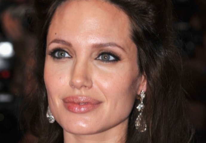 HTJELA JE USNE KAO U ANGELINE JOLIE: Od plastičara se vratila sa UNIŠTENIM ŽIVOTOM, nije mogla ZATVORITI USTA! (FOTO)