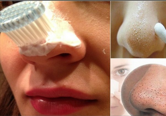 OVO MORATE VEĆ DANAS DA PROBATE: Evo kako da očistite pore i uklonite ružne mitisere uz pomoć samo OBIČNE četkice za zube i OVOGA