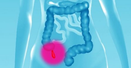 AKO JOŠ UVIJEK IMATE SLIJEPO CRIJEVO, OBRATITE PAŽNJU: Prijeti vam opasna bolest! 