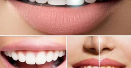 Stomatološka ordinacija 3D misli na Vas! Profesionalno izbjeljivanje zuba uz 70% POPUSTA!