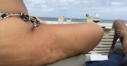 NJENO TIJELO JE SAVRŠENO NA INSTAGRAMU, A UŽIVO KATASTROFA: Procurile fotografije slavne LJEPOTICE, CELULITA NA SVE STRANE!