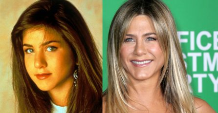 POTPUNA TRANSFORMACIJA! Poznate dame koje su samo jednim plastičnim zahvatom potpuno promijenile lični opis!