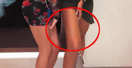 UHVAĆENA JE U PHOTOSHOP PREVARI: Pokušala je sakriti ovu sramotu, ali kada vidite njeno lice shvatit ćete šta je TUGA! 