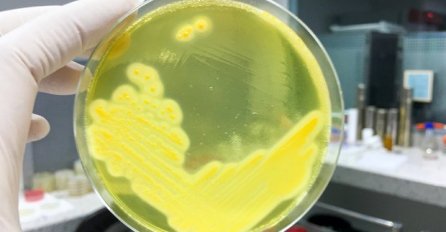 JE LI OVO NAŠ KRAJ? SUPERBAKTERIJA otporna na ANTIBIOTIKE hara bolnicama! Doktori se hvataju za glavu! Ovo ne sluti na dobro!