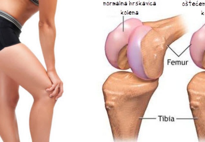 bol u zglobovima laktovima koljena