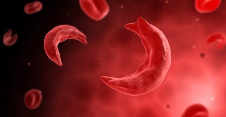 OVO JE NAJJAČA BOMBA ZA KRVNU SLIKU: Zaboravite na BOLJKE, ova 3 sastojka će vas preporoditi!