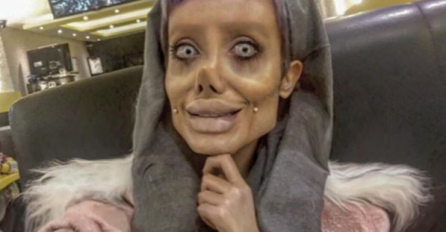 SJEĆATE SE ANGELINE IZ NOĆNE MORE? Uradila je još jednu operaciju na sebi, UDAHNITE DUBOKO I POGLEDAJTE KAKO SADA IZGLEDA (FOTO)