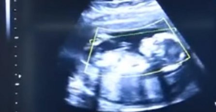 "Uradila sam test i saznala da trudna sam. Nisam mu za to rekla i nikad neće saznati..."