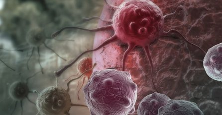 Upozorenje stručnjaka: Doći će do globalne eksplozije raka!