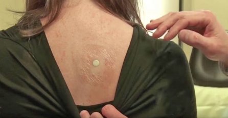 DOKTOR JE ZALIJEPIO MALU BATERIJU NA NJENA LEĐA I DONIO JOJ OGLEDALO: Ono što je vidjela pamtiće do kraja života (FOTO)