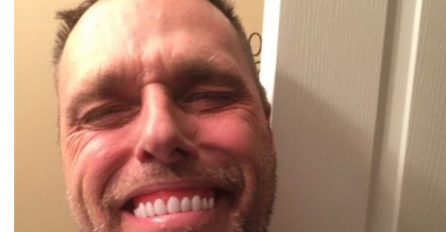 Kupio sam navlaku za zube da bi imao ljepši osmijeh: Rezultat je nasmijao sve osim njega, VIDITE LI ZAŠTO?