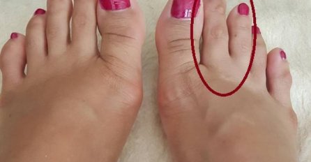 IMATE LI OVAKAV NOŽNI PRST? Mnogima je ovo odvratno, A EVO KAKVU TAJNU KRIJE!