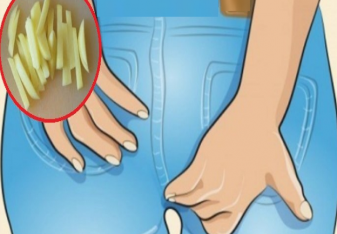 PROVJERENO DJELUJE: Ruski recept sa kojim ćete se riješiti hemoroida za 2 dana