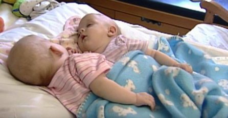 ROĐENE SU KAO SIJAMSKE BLIZANKINJE, BILO IH JE NEMOGUĆE RAZDVOJITI: Evo kako one izgledaju 10 GODINA KASNIJE! (FOTO)