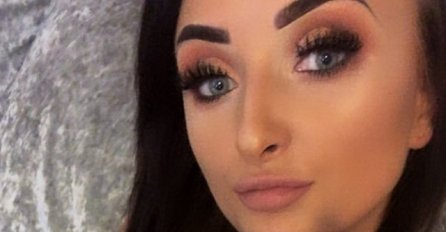 KUPILA JE FILERE ZA USNE NA AKCIJI: Kad ih je ugradila u dnevnoj sobi nastao je HAOS, EVO U ŠTA SE PRETVORILA (FOTO)