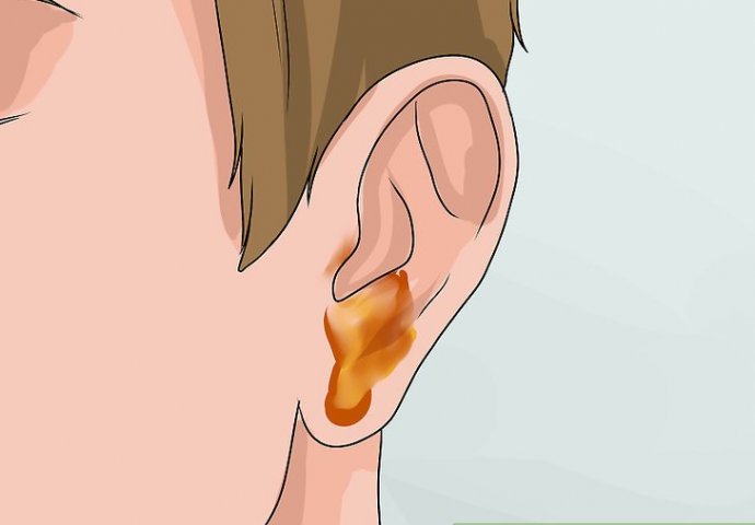 ŽIGA VAS UHO? Ovaj prirodni lijek će ukloniti bol i infekcije, A POTPUNO JE SIGURAN I ZA DJECU!