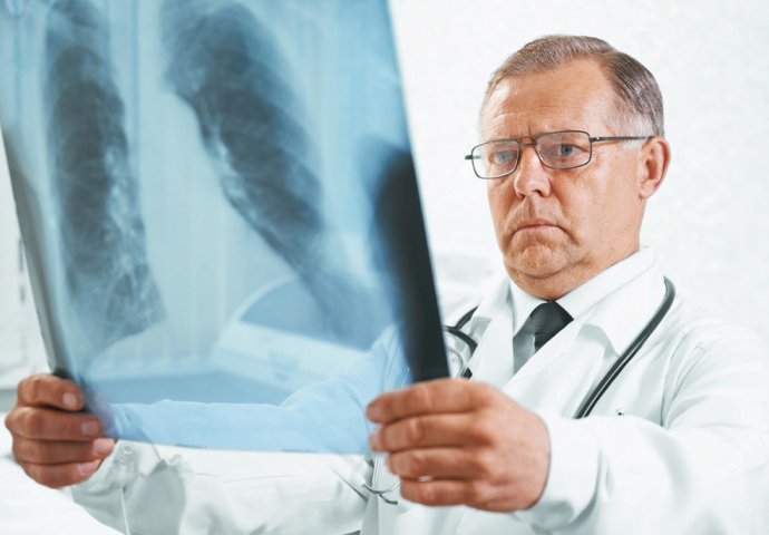 OVO JE NAJPODMUKLIJI KARCINOM: Otišla je kod doktora po lijekove za srce, i saznala da ima RAK 