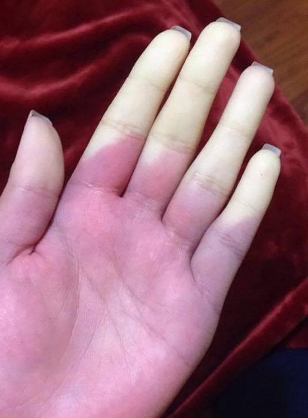 1545922450349-raynauld-830x0