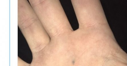 AKO STE SE U ŠKOLI BOCKALI OLOVKOM, VJEROVATNO IMATE POSLJEDICE: Svi dijele ovu sliku, ODMAH PROVJERITE RUKE (FOTO)