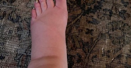 PJEVAČICA SAMO ŠTO NIJE RODILA, A SAD JE OBJAVILA OVU SLIKU: "Pomozite! Imate li lijek za OVO?" (FOTO)