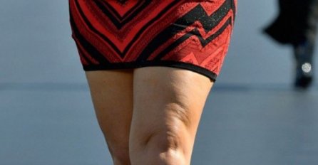 CELULIT KIPTI, A ONA NOSI MINIĆ: Svi su joj govorili da je debela da bi se bavila manekenstvom 