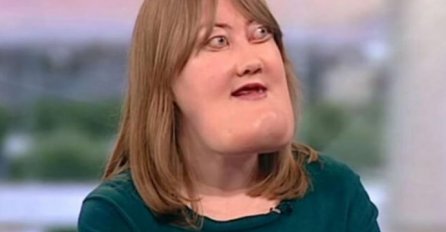 SJEĆATE SE ŽENE KOJOJ JE BRADA RASLA BEZ PRESTANKA: Ovo je ona danas (VIDEO) 