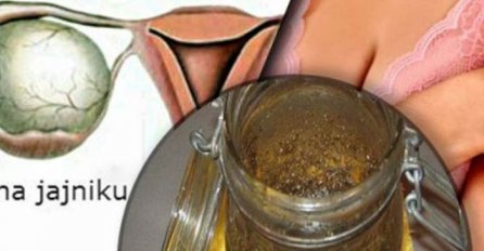LIJEK KOJI SVAKA ŽENA TREBA ZNATI: Uklanja neugodne mirise, smanjuje sekret I LIJEČI MIOME!