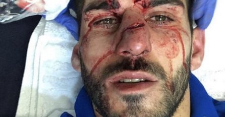 OVO ĆE PAMTITI DO KRAJA ŽIVOTA: Tek došao u novi klub i odmah su mu unakazili lice, UŽAS