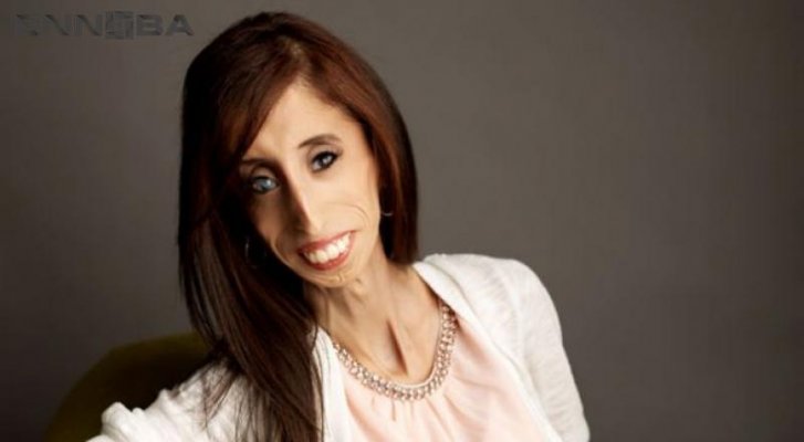 lizzie-velasquez-7