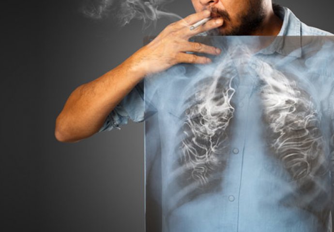 SVAKI PUŠAČ TREBA ZNATI ZA OVAJ NAPITAK: Očistiće vam pluća, ublažiti kašalj i pun je vitamina (RECEPT)
